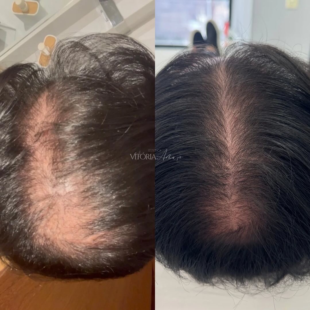 Tratamento capilar antes e depois